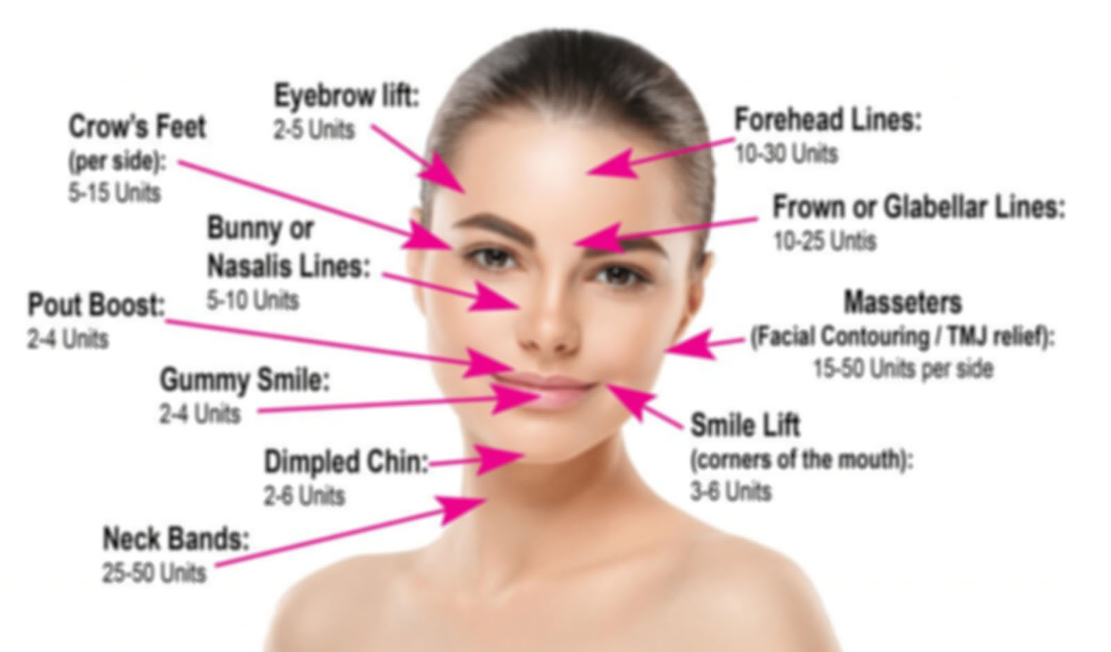 Anti-Wrinkle Injections